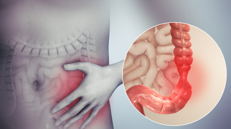 nutricionista sii